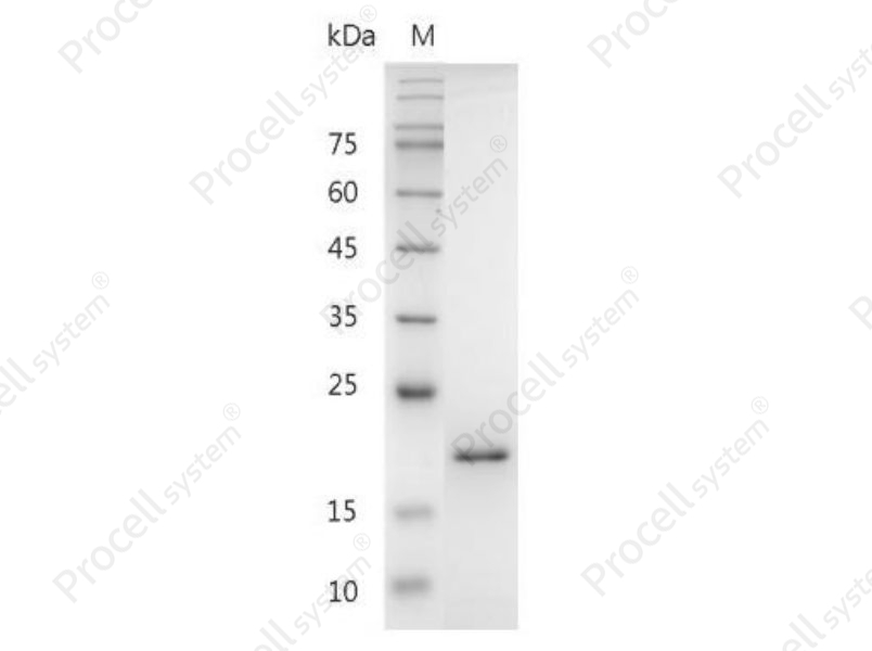 FasL/TNFSF6/CD95L/CD178, Mouse, Recombinant