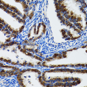 Immunohistochemistry of paraffin-embedded Rat fallopian tube using HSPH1 Polyclonal Antibody at dilution of  1:100 (40x lens).