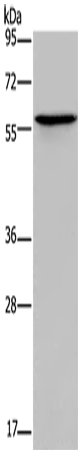 Western Blot analysis of Human lung cancer tissue using ADRA1B Polyclonal Antibody at dilution of 1:550