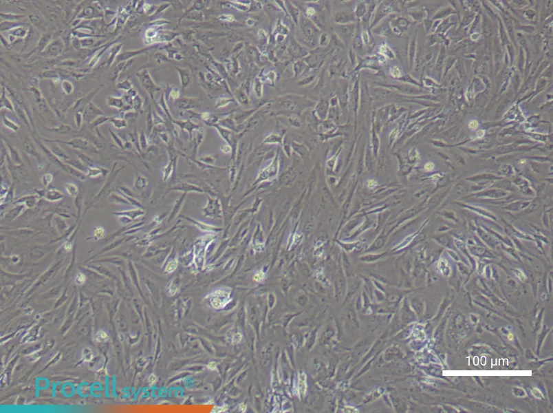 Mouse  Follicle Membrane Cell Complete Medium - 1