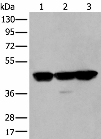 Western blot analysis of Hela A431 and Hepg2 cell lysates  using PLAG1 Polyclonal Antibody at dilution of 1:200