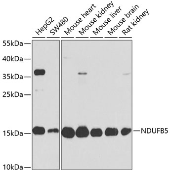 Western blot analysis of extracts of various cell lines using NDUFB5 Polyclonal Antibody at 1:1000 dilution.