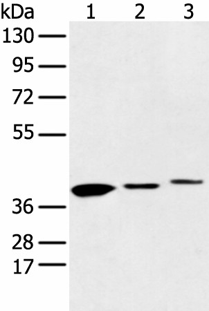 Western blot analysis of 231 cell Human fetal liver and Human fetal brain tissue  using MAT2B Polyclonal Antibody at dilution of 1:500