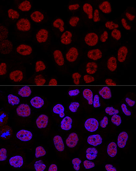 Confocal immunofluorescence analysis of Hela cells using CTCF Polyclonal Antibody at dilution of 1:200. Blue: DAPI for nuclear staining.