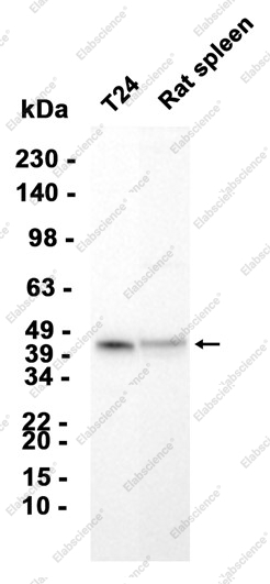 Recombinant ACAT1 Monoclonal Antibody - 2