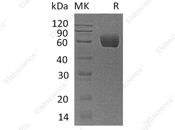 Recombinant Human Angiotensinogen/AGT Protein (His Tag) - 1