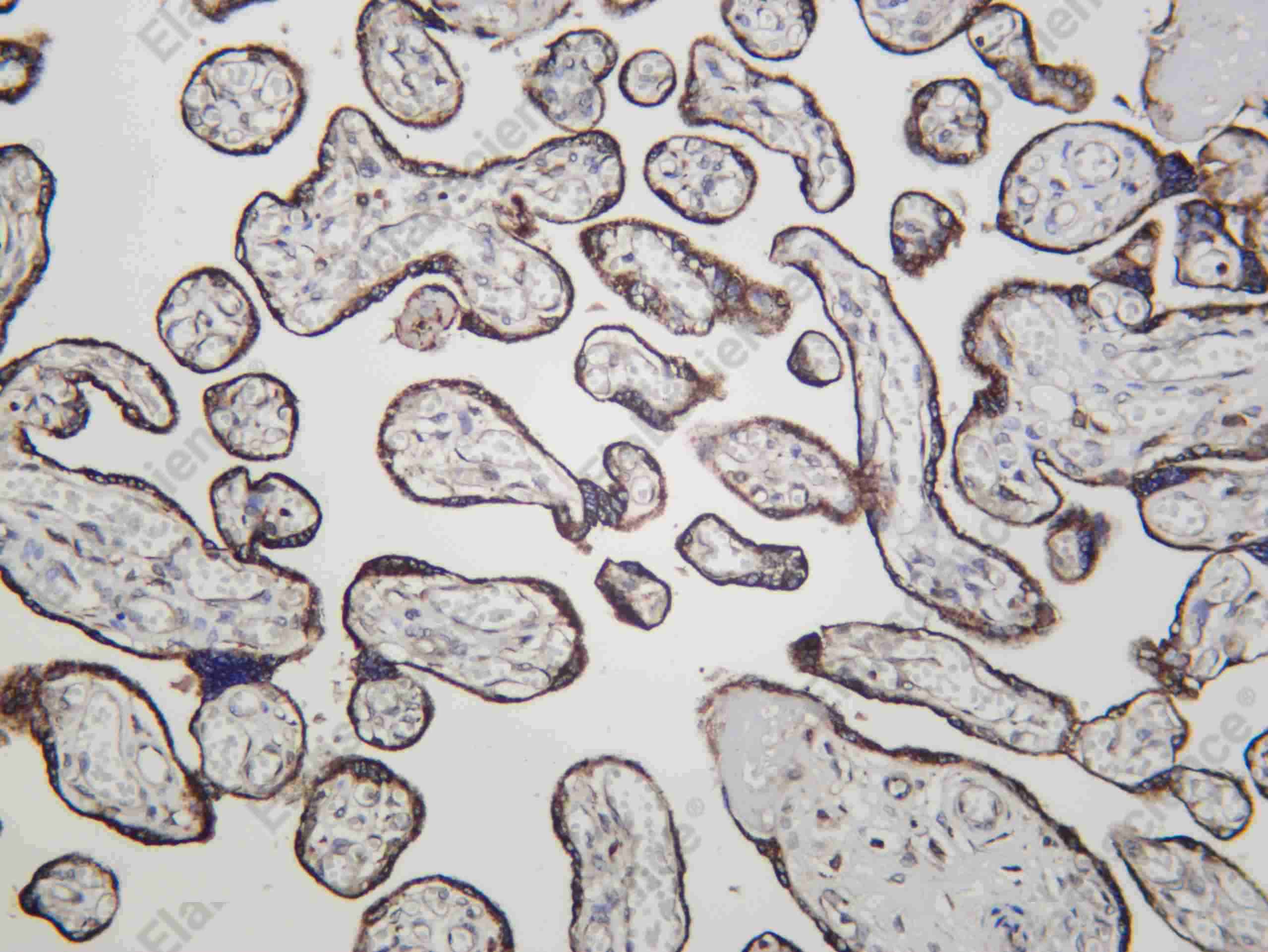 Recombinant CYP11A1 Monoclonal Antibody - 1