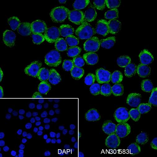 Recombinant KRAS Monoclonal Antibody - 2
