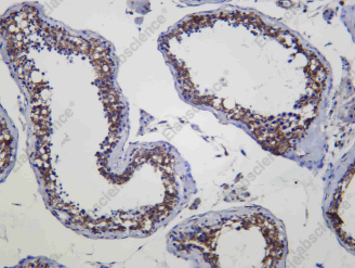 Recombinant TSPO Monoclonal Antibody - 1
