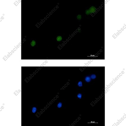 Recombinant DKC1 Monoclonal Antibody - 3