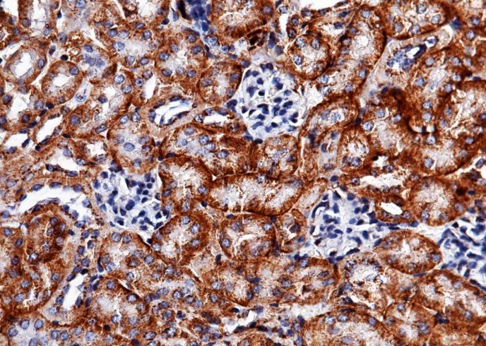 Recombinant Carbonic Anhydrase XII/Car12 Monoclonal Antibody-searchlist-1