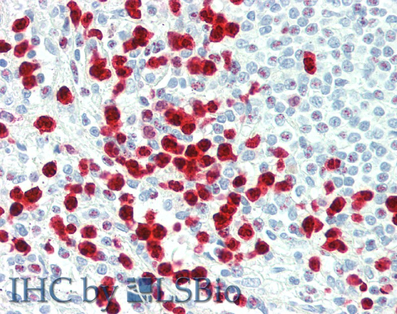 Immunohistochemistry of paraffin-embedded Spleen tissue using S100A12 Polyclonal Antibody at dilution of 1:60(Elabscience Product Detected by Lifespan).