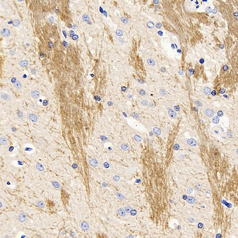 Immunohistochemistry analysis of paraffin-embedded rat brain  using MBP Polyclonal Antibody at dilution of 1:300.