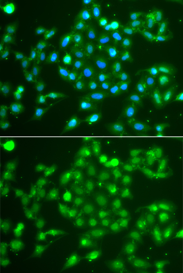 Immunofluorescence analysis of A549 cells using UCHL5 Polyclonal Antibody