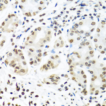 Immunohistochemistry of paraffin-embedded Human stomach using IGF2BP1 Polyclonal Antibody at dilution of  1:100 (40x lens).