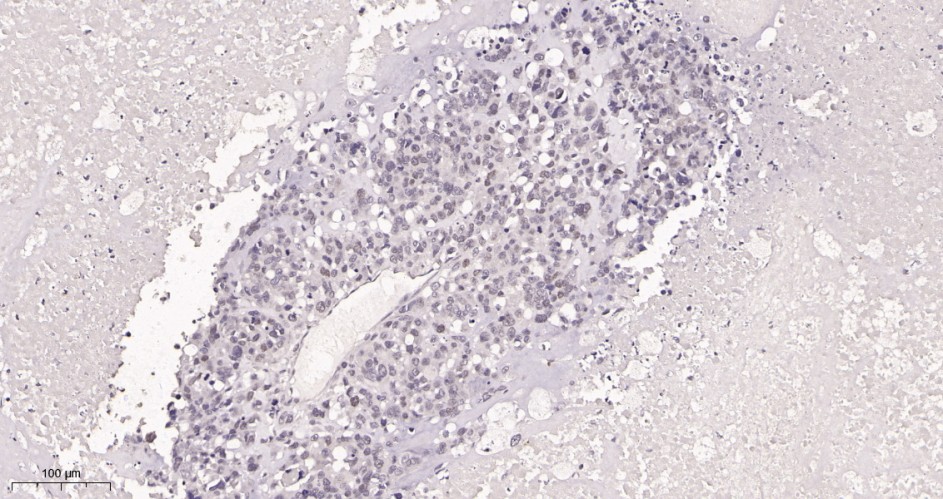 Recombinant c-Myc Monoclonal Antibody - small - 2