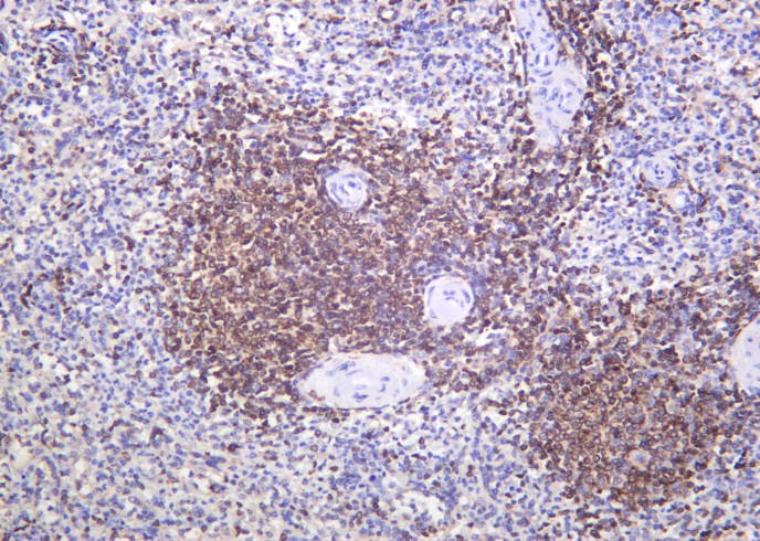 Recombinant Bcl-2 Monoclonal Antibody - small - 2
