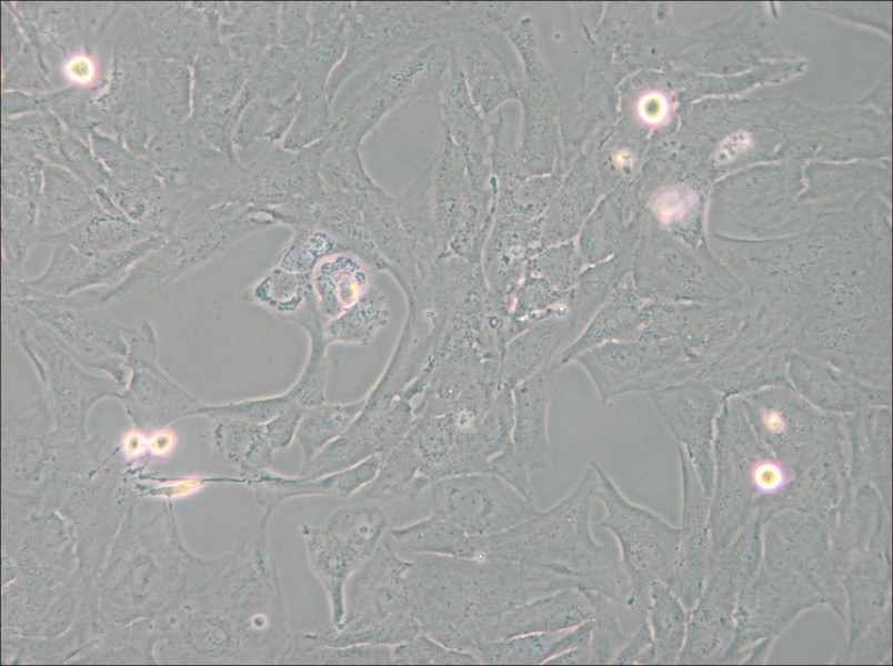 NCI-H196 Cell Complete Medium - small - 4