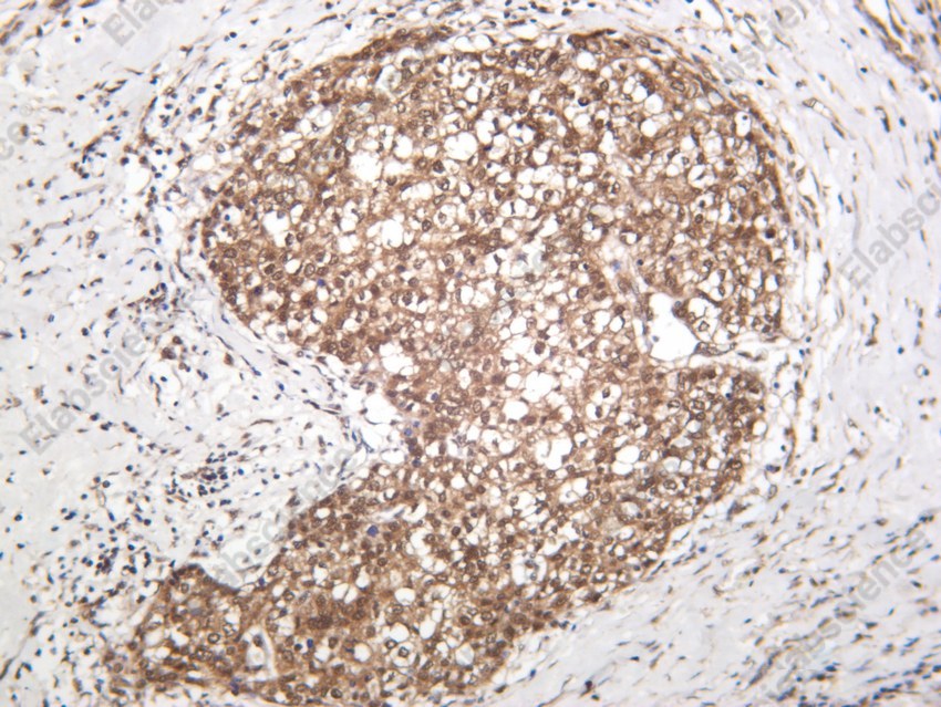 Recombinant ERK1/2 Monoclonal Antibody - 3