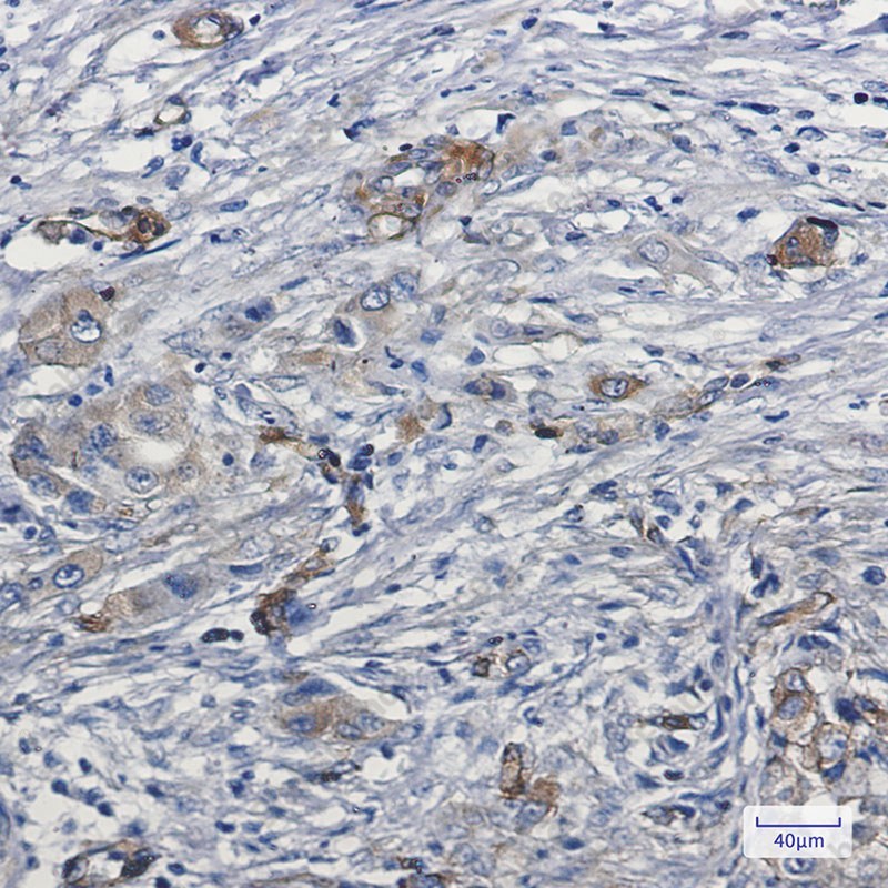 Recombinant MYO1B Monoclonal Antibody - 3