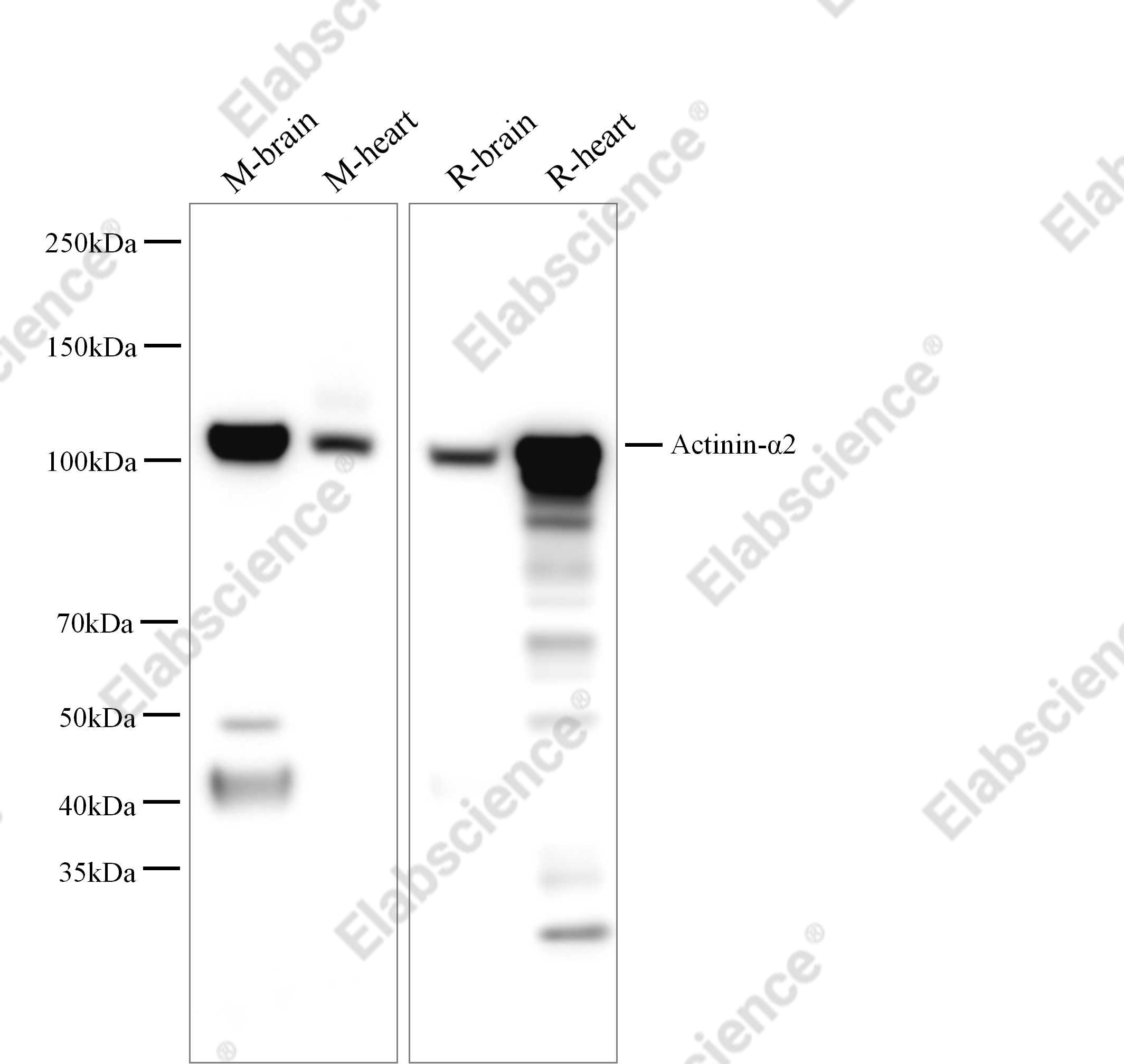 Recombinant Actinin-α2 Monoclonal Antibody - 3
