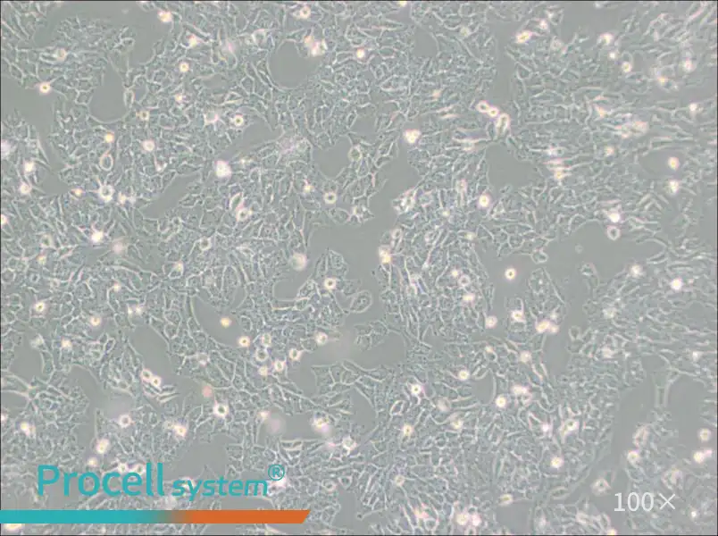 SK-N-AS Cell Complete Medium - 3