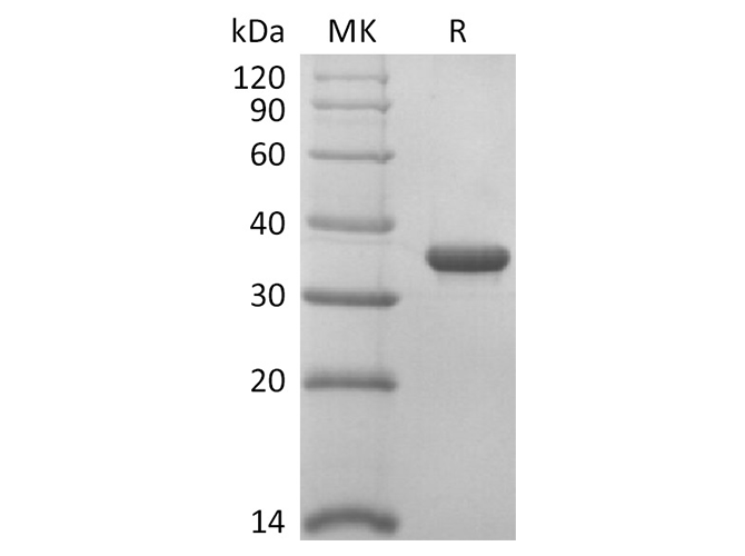 Recombinant 2019-nCoV Papain-Like Protease Protein