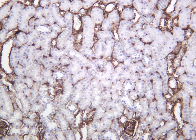 Recombinant Annexin II Monoclonal Antibody - 1