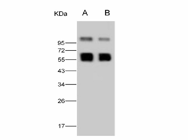 Western Blot analysis of Recombinant WNV (lineage 1, strain NY99) NS1 Protein (His Tag)(PKSV030261 with 30ng and 10ng) using Anti-West Nile Virus(WNV)(lineage 1, strain NY99) NS1 Polyclonal Antibody at dilution of 1:2000.