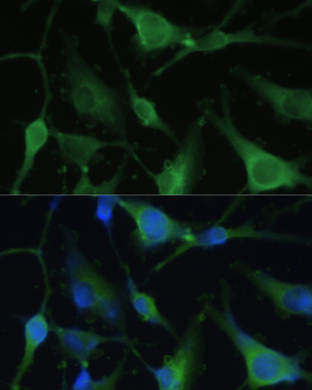 Immunofluorescence analysis of U-251 MG cells using FABP7 Polyclonal Antibody at dilution of 1:100. Blue: DAPI for nuclear staining.