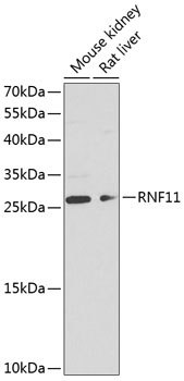 Western blot analysis of extracts of various cell lines using RNF11 Polyclonal Antibody at dilution of 1:1000.