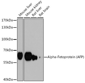 Western blot analysis of extracts of various cell lines using Alpha-Fetoprotein (Alpha-Fetoprotein (AFP)) Polyclonal Antibody at 1:1000 dilution.