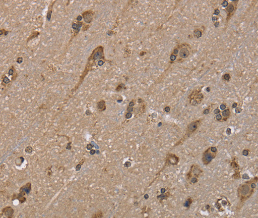 Immunohistochemistry of paraffin-embedded Human brain  tissue using GADD45B Polyclonal Antibody at dilution 1:40