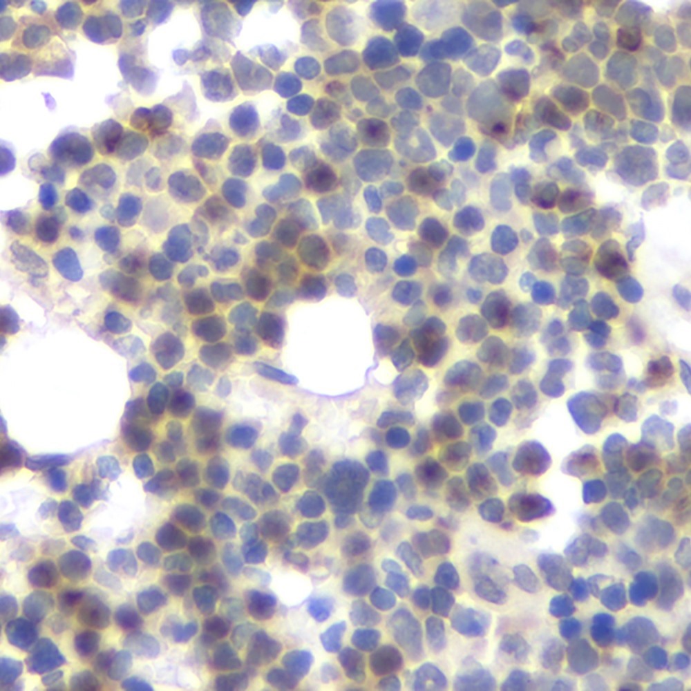 Immunohistochemistry analysis of paraffin-embedded rat bone  using MMP13 Polyclonal Antibody at dilution of 1:200.