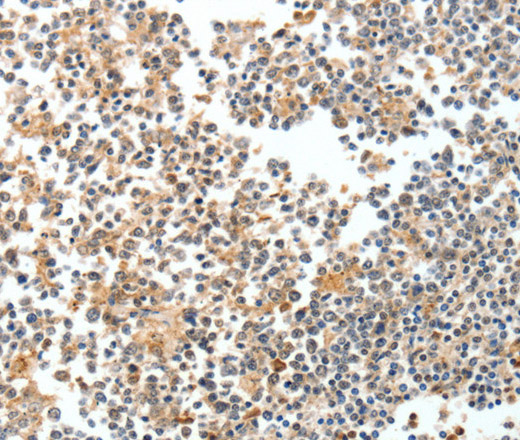 Immunohistochemistry of paraffin-embedded Human tonsil tissue using SPDEF Polyclonal Antibody at dilution 1:60