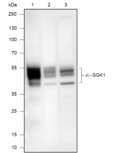 Recombinant SGK1 Monoclonal Antibody-searchlist-1