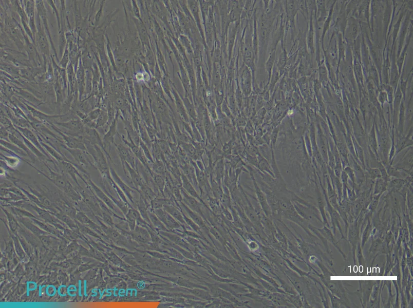 Human Esophageal Cancer Fibroblast Complete Medium - 2
