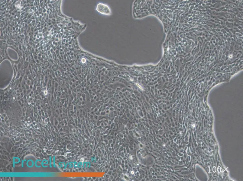 Calu-3 Cell Complete Medium - 1