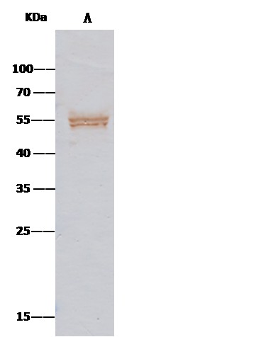 Recombinant SerpinA8/Angiotensinogen/AGT Monoclonal Antibody - small - 3