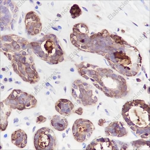 Recombinant GCDFP-15 Monoclonal Antibody - 1