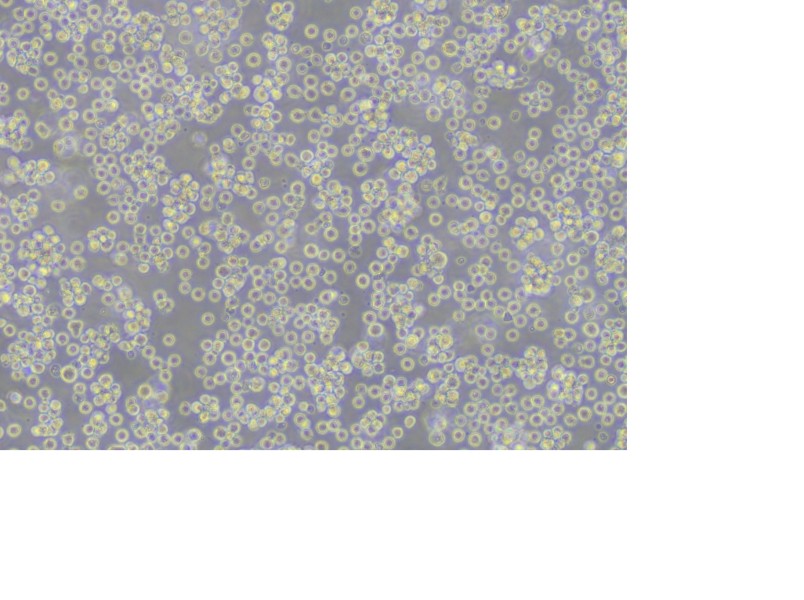 REC-1 Cell Complete Medium - 5