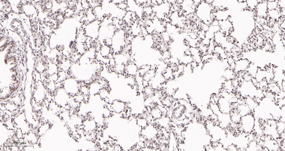 Recombinant ATF-4 Monoclonal Antibody - small - 3