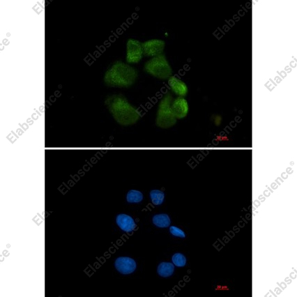 Recombinant USP13 Monoclonal Antibody - 2