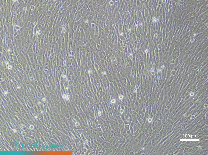 Human Ovarian Cancer Fibroblast (Primary cell immortalization) Complete Medium - 2