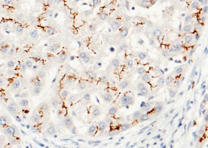 CEACAM1/CD66a Monoclonal Antibody - small - 2