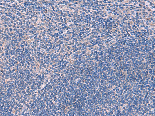 Immunohistochemistry of paraffin-embedded Human tonsil tissue  using SCCPDH Polyclonal Antibody at dilution of 1:85(?200)