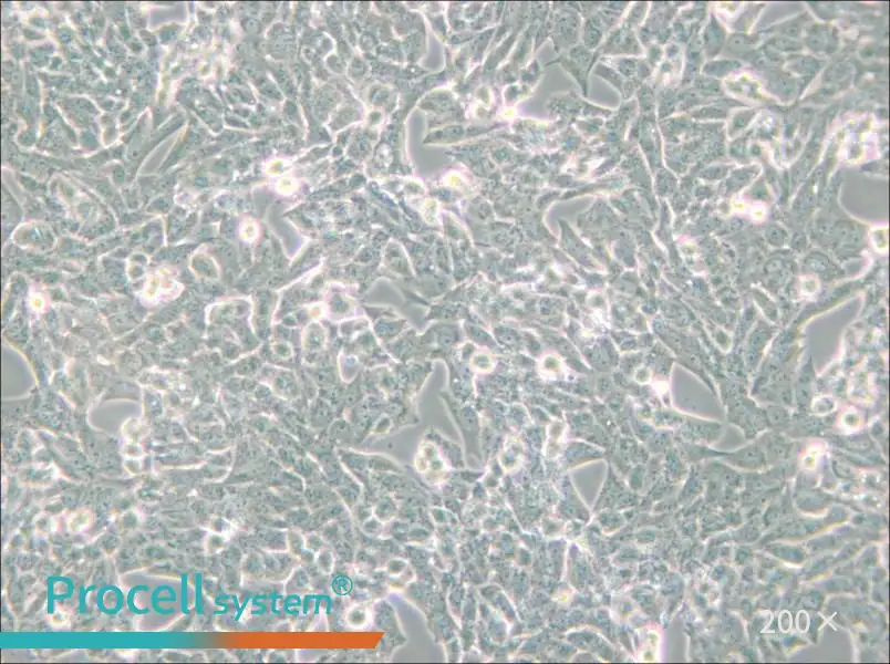 NCI-H295R Cell Complete Medium - small - 4