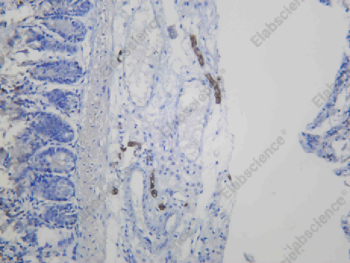 Recombinant Myelin Protein Zero Monoclonal Antibody - 2