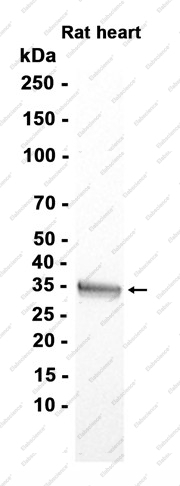 Recombinant USF1 Monoclonal Antibody - 2