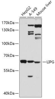 Western blot analysis of extracts of various cell lines using LIPG Polyclonal Antibody at 1:500 dilution.